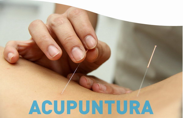 acupuntura_1